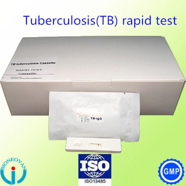 CE approved Tuberculosis TB Rapid Test