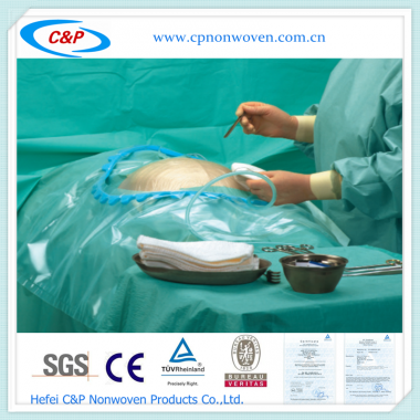 Non-sterile Surgical C-section Drape Set/Caesarean Drape Pack