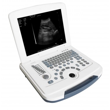 Mslpu09-Laptop Ultrasound Machine-/Easytaking Portable Ultrasonic Instrument/Equipment
