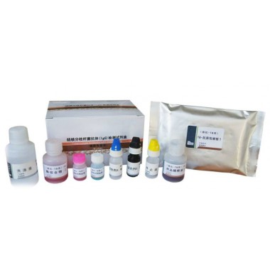Tuberculosis Antibody(IgG) Detection Kit (ELISA)
