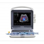 Medical Equipment 3D/4D Color Doppler Portable Ultrasound Scanner