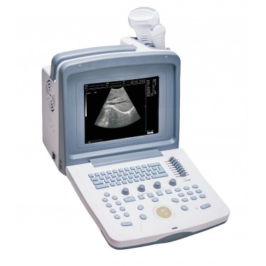 S880 Prime Portable Ultrasound Scanner