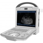 Canyearn A65 Full Digital Portable Ultrasonic Diagnostic System Black and White Ultrasound Scanner