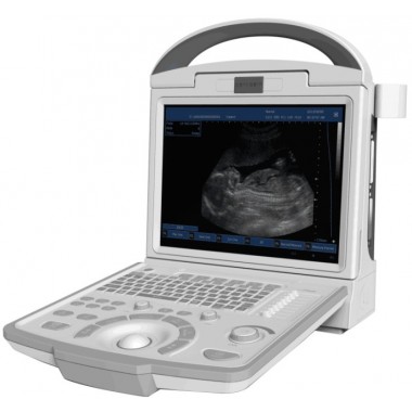 Canyearn A65 Full Digital Portable Ultrasonic Diagnostic System Black and White Ultrasound Scanner