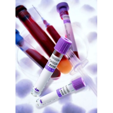 EDTA Vacuum Blood Collection Tubes