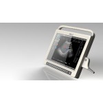 Eye 6 Ultrasound Scanner