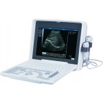 S880 Plus Portable Ultrasound Scanner