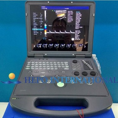 PC Based Portable Color Doppler Digital Ultrasound