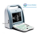 Eyes Ultrasound Scanner for Eyes Hospital Ophthalmic Ultrasound