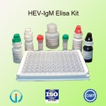 CE certificate hev elisa test kit/Hepatitis E Virus elisa test