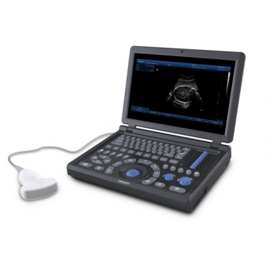 Canyearn A15 Full Digital Laptop Ultrasonic Diagnostic System